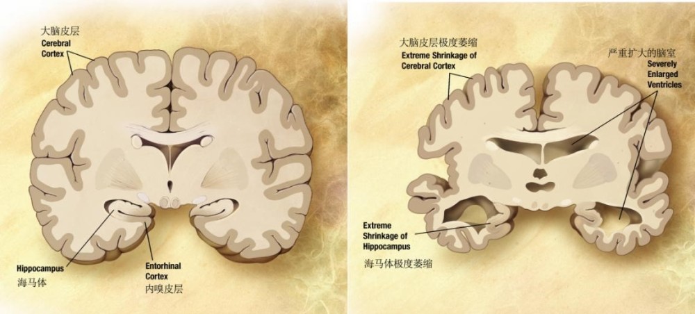 精神病学的历史沿革与学科发展概述