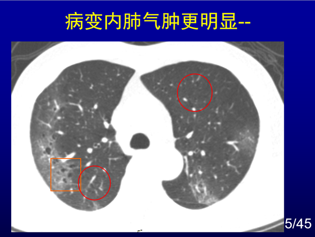 新冠肺炎起源探究
